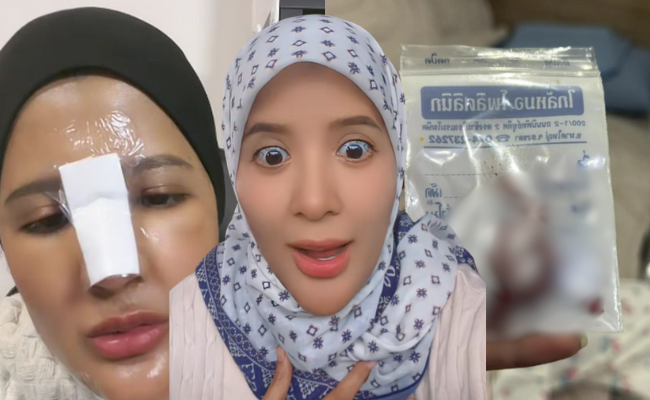 Nur Nilam Dah Buang Silikon Di Hidung, Rancang Nak Buang Tatu Pula – ‘Sekurangnya Allah Lihat Usaha Saya’