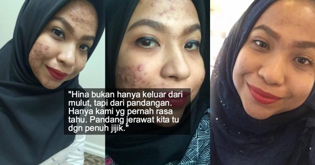 Gelilah Tengok Muka Kau! – Lagi Kisah Dihina & Diperli 