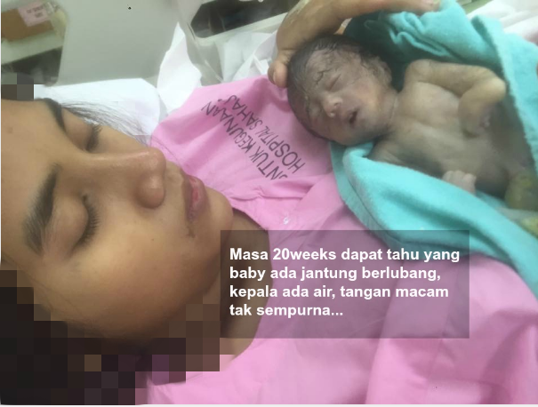 Bayi Dalam Kandungan Bermasalah & Sukar Dilahirkan, Setelah Berjumpa Ustaz Rupa-Rupanya Wanita Ini…