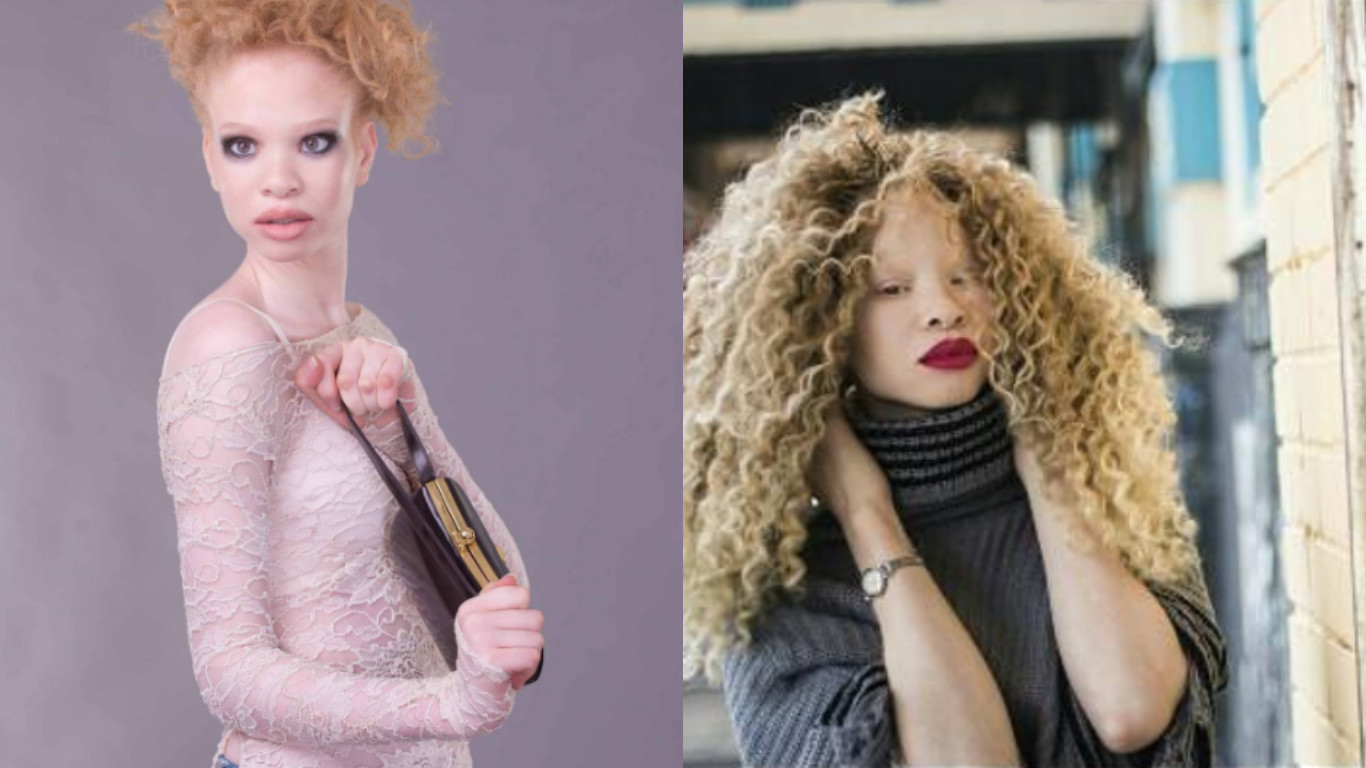 Gadis Albino Dulu Digelar Hantu, Kini Model Antarabangsa. Cantiknya!