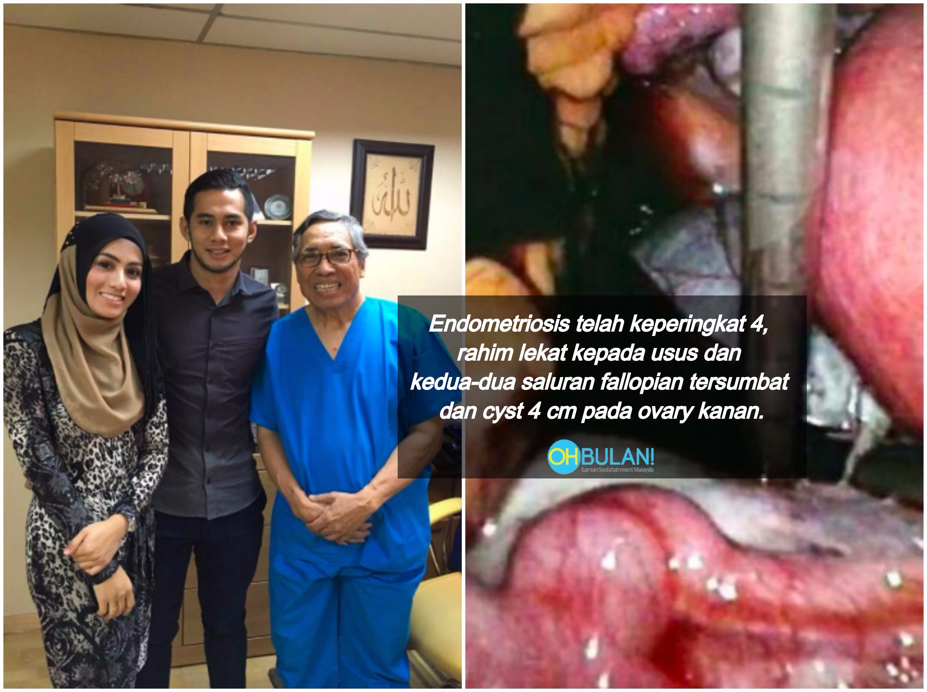 Hidap Endometriosis Punca Isteri Fizo Omar Sukar Hamil, Doktor Ini Kongsi Cara Rawatan