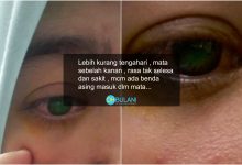 ‘Penglihatan Semakin Kabur..’ -Gadis Ini Kongsi Derita Gara-Gara Sepasang Contact Lens. Takutnya!
