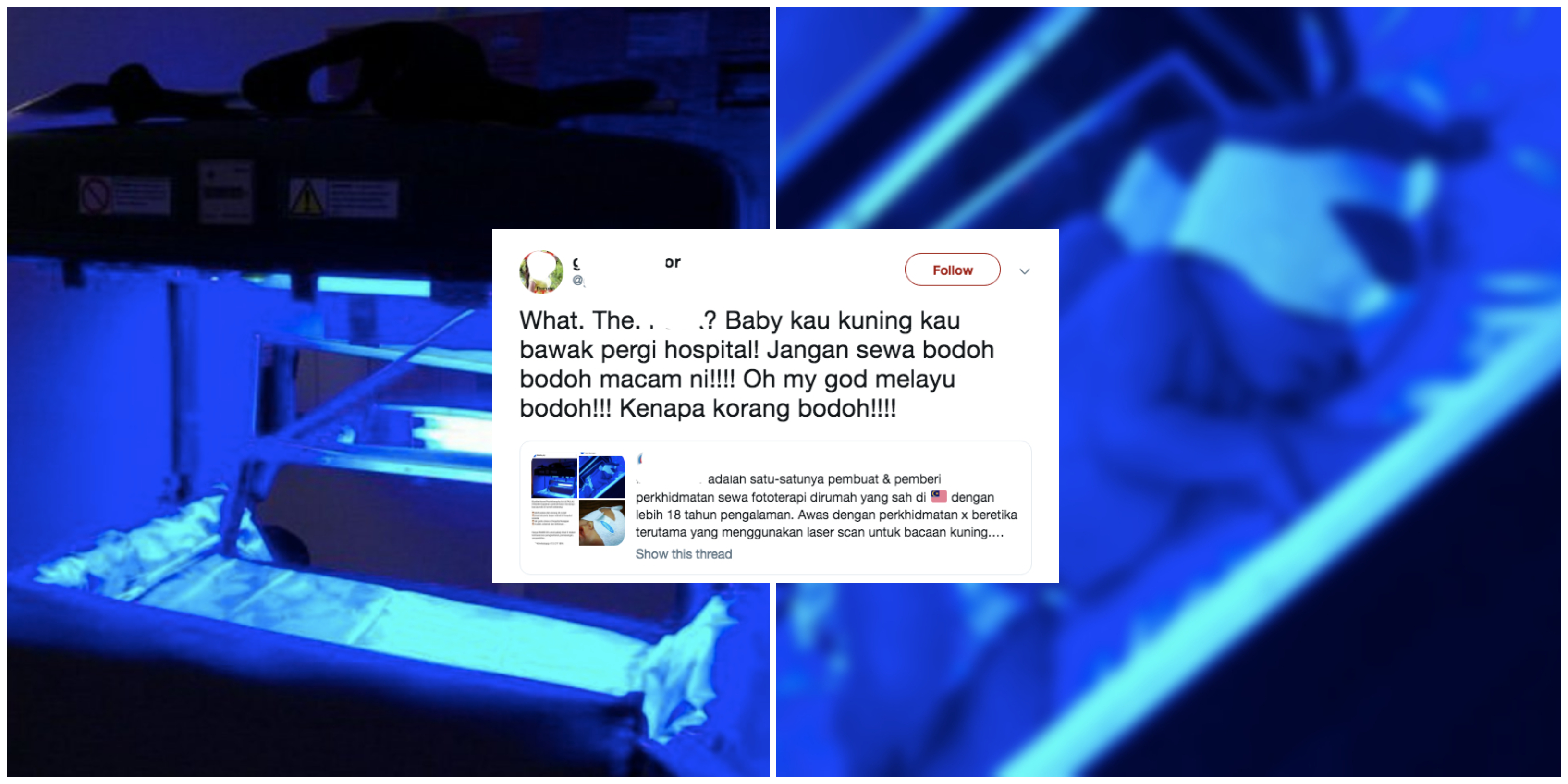 Netizen Berbalah Isu Penggunaan ‘Lampu Biru’ Untuk Merawat Bayi- Selamat Atau Tidak?