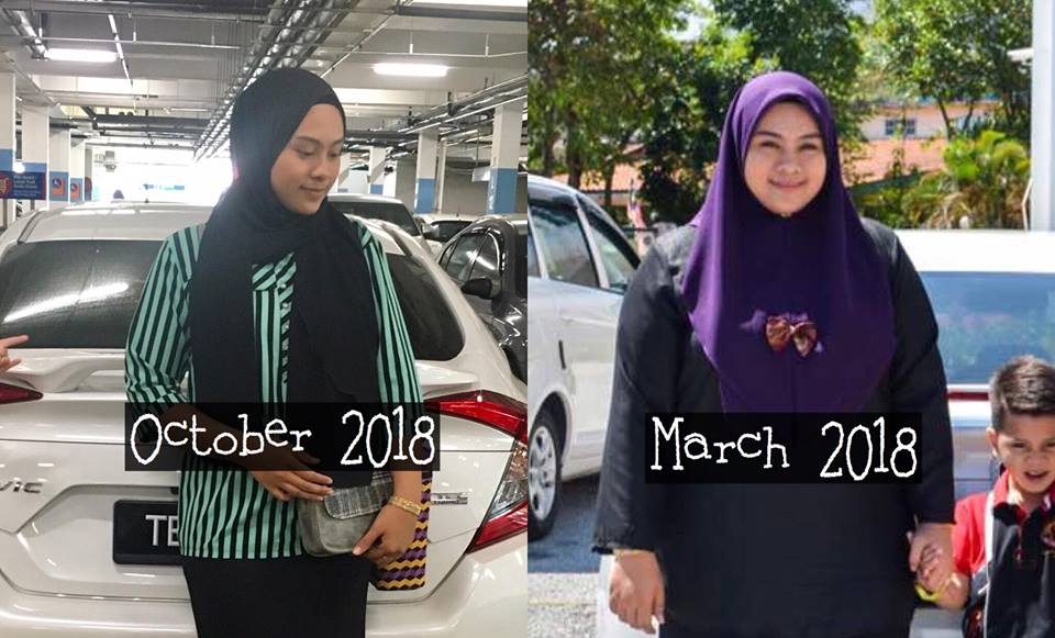 Turun 35.5kg Dalam Masa 8 Bulan, Wanita Ini Kongsi Tips Kurus Cara Sihat
