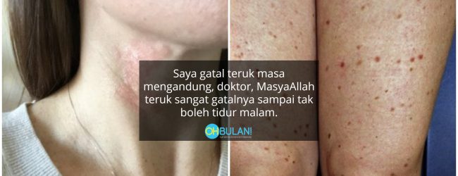 Alahan Obstetric Cholestasis Semasa Mengandung