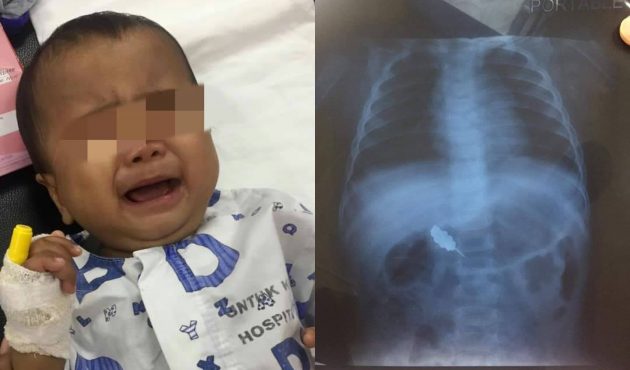 Viral Bayi Tertelan Kerongsang, Mustajab Doa Netizen Pin Tertutup & Keluar Melalui Najis