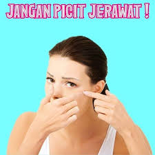 “Jangan Picit Jerawat”- 4 Cara Hilangkan Jerawat Dengan Cepat